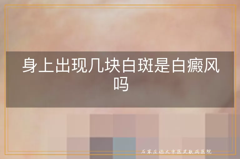 身上出现几块白斑是白癜风吗