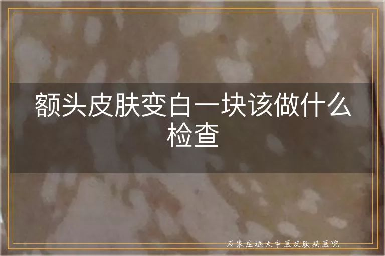 额头皮肤变白一块该做什么检查