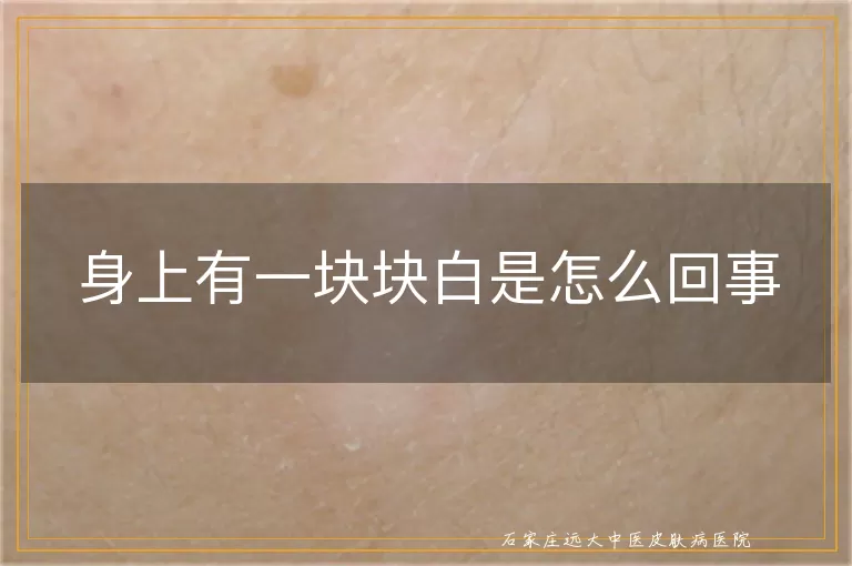身上有一块块白是怎么回事