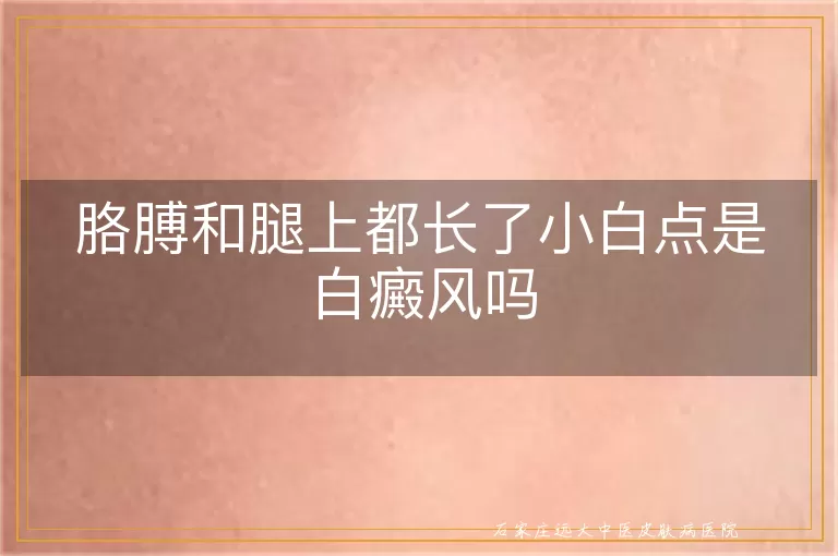 胳膊和腿上都长了小白点是白癜风吗