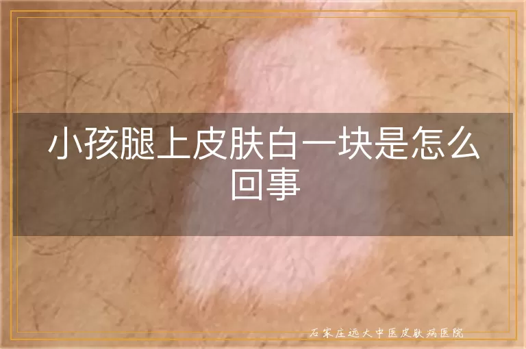 小孩腿上皮肤白一块是怎么回事