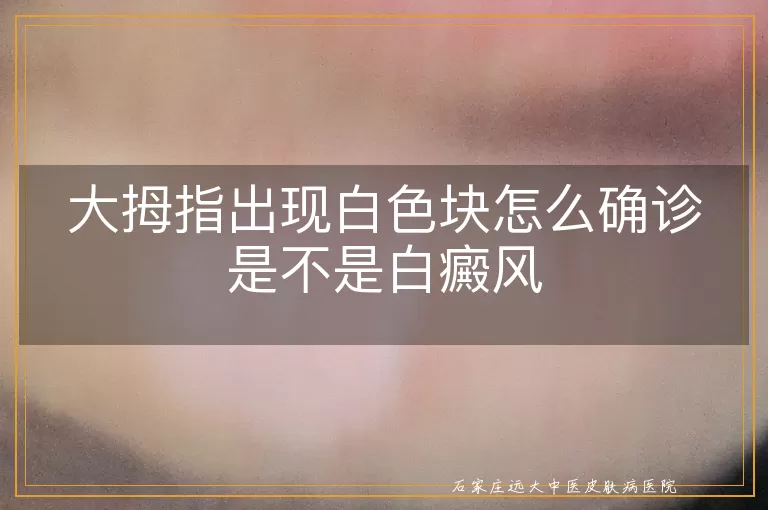 大拇指出现白色块怎么确诊是不是白癜风
