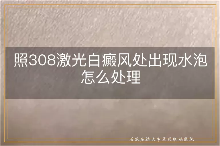 照308激光白癜风处出现水泡怎么处理