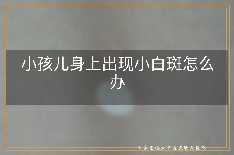 小孩儿身上出现小白斑怎么办