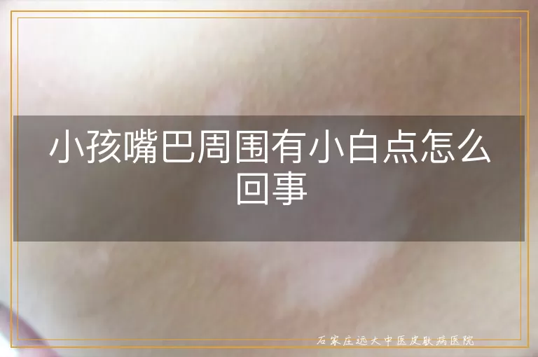 小孩嘴巴周围有小白点怎么回事
