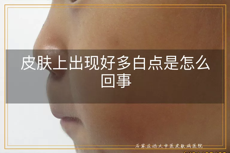 皮肤上出现好多白点是怎么回事