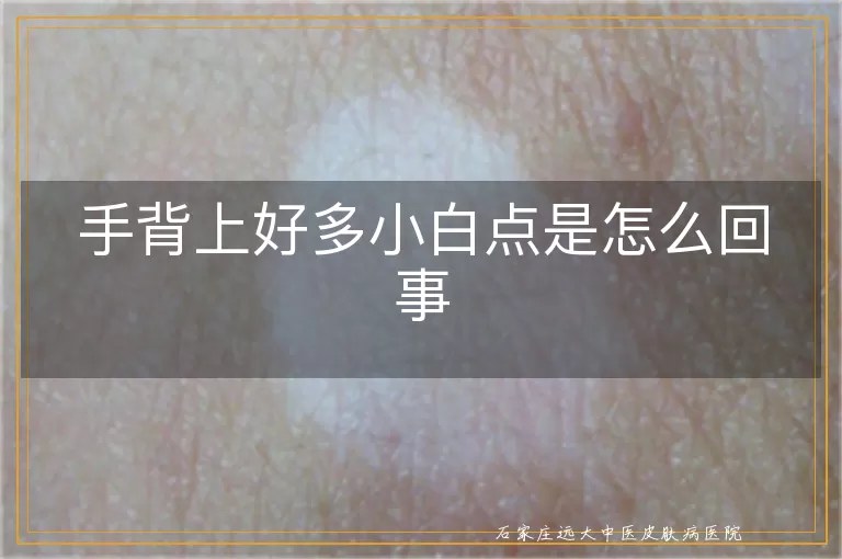 手背上好多小白点是怎么回事