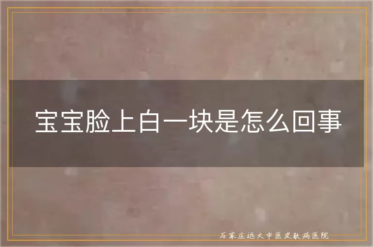 宝宝脸上白一块是怎么回事