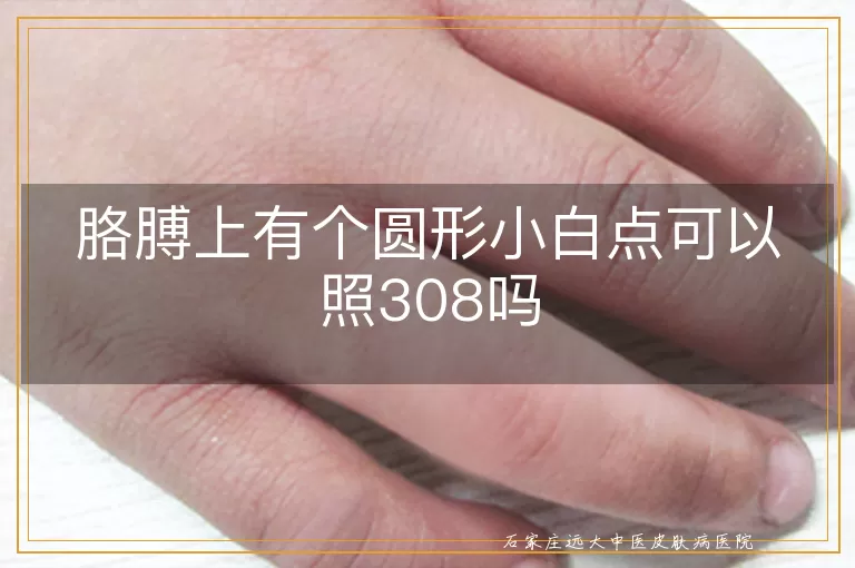 胳膊上有个圆形小白点可以照308吗