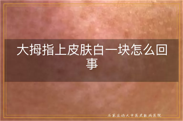 大拇指上皮肤白一块怎么回事