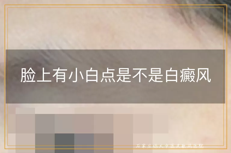 脸上有小白点是不是白癜风