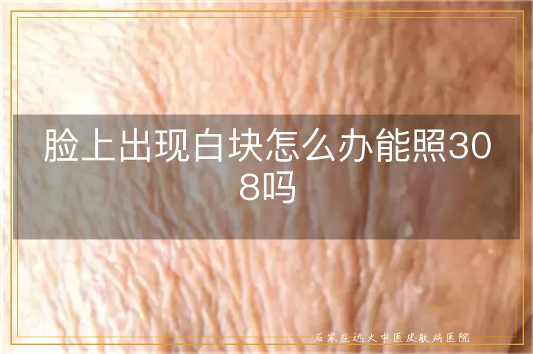 脸上出现白块怎么办能照308吗
