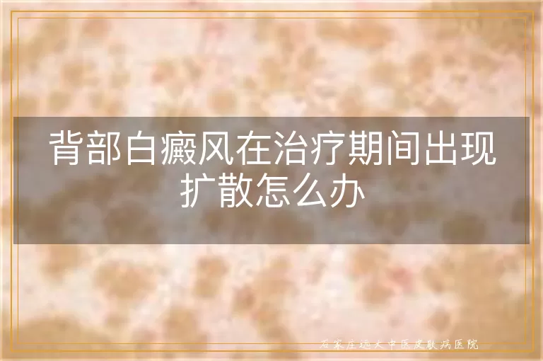 背部白癜风在治疗期间出现扩散怎么办