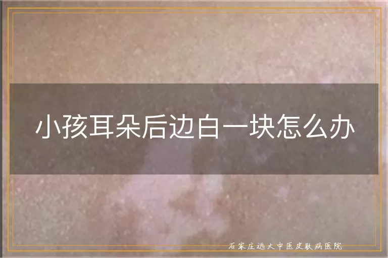 小孩耳朵后边白一块怎么办