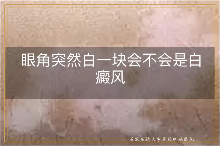 眼角突然白一块会不会是白癜风