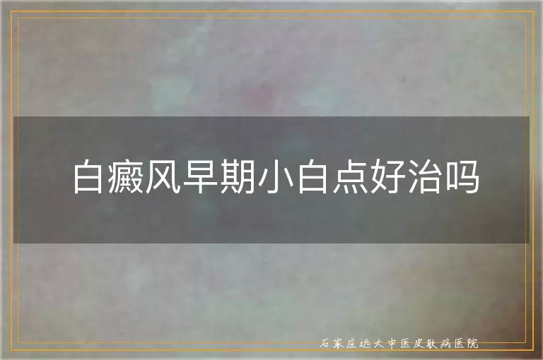 白癜风早期小白点好治吗