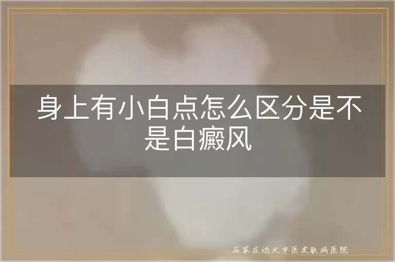 身上有小白点怎么区分是不是白癜风
