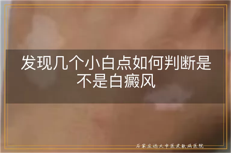 发现几个小白点如何判断是不是白癜风