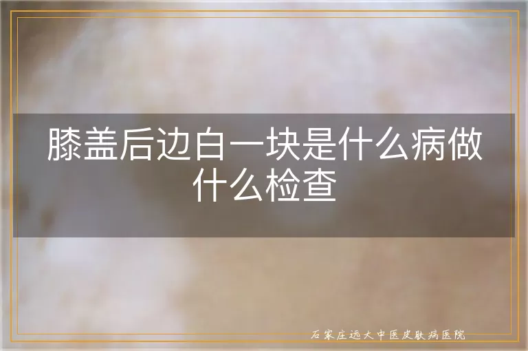 膝盖后边白一块是什么病做什么检查
