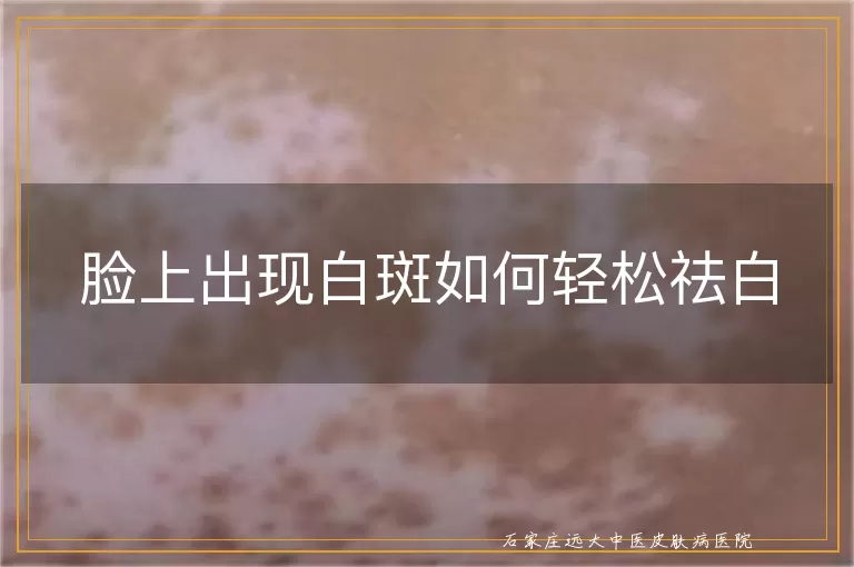 脸上出现白斑如何轻松祛白
