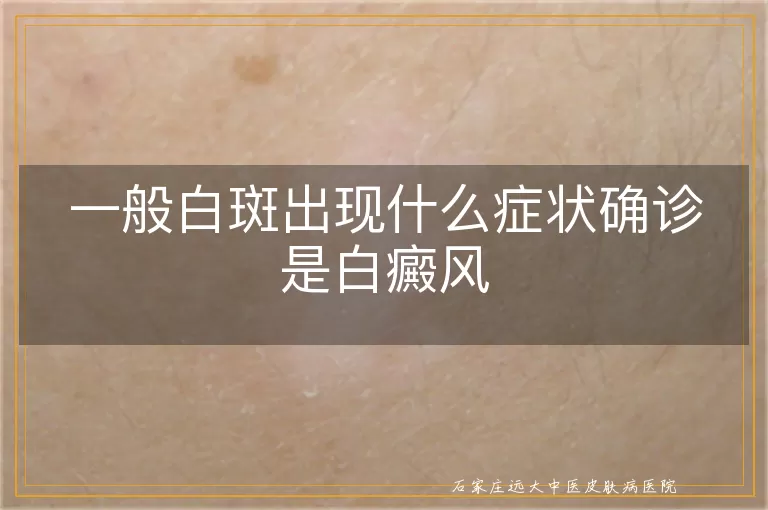 一般白斑出现什么症状确诊是白癜风
