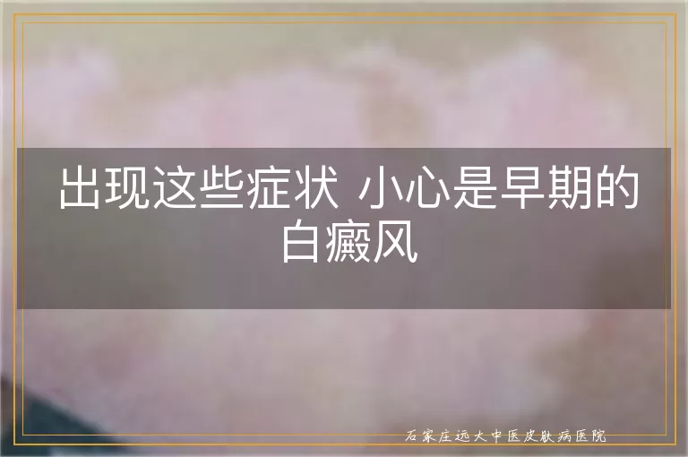 出现这些症状 小心是早期的白癜风