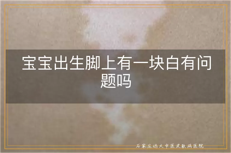 宝宝出生脚上有一块白有问题吗