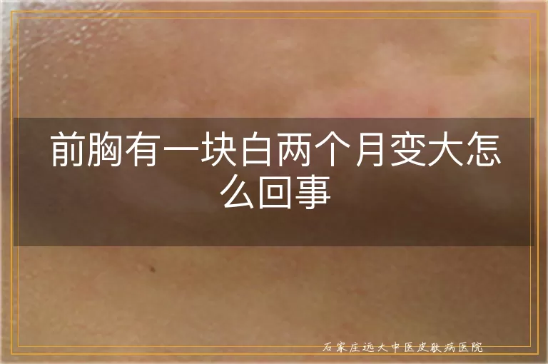 前胸有一块白两个月变大怎么回事