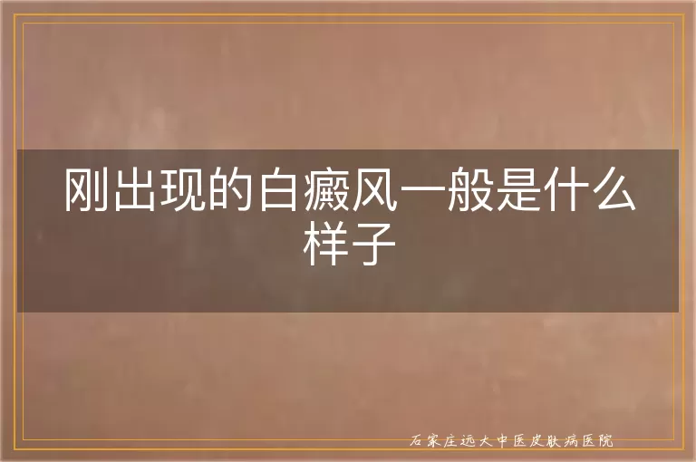 刚出现的白癜风一般是什么样子