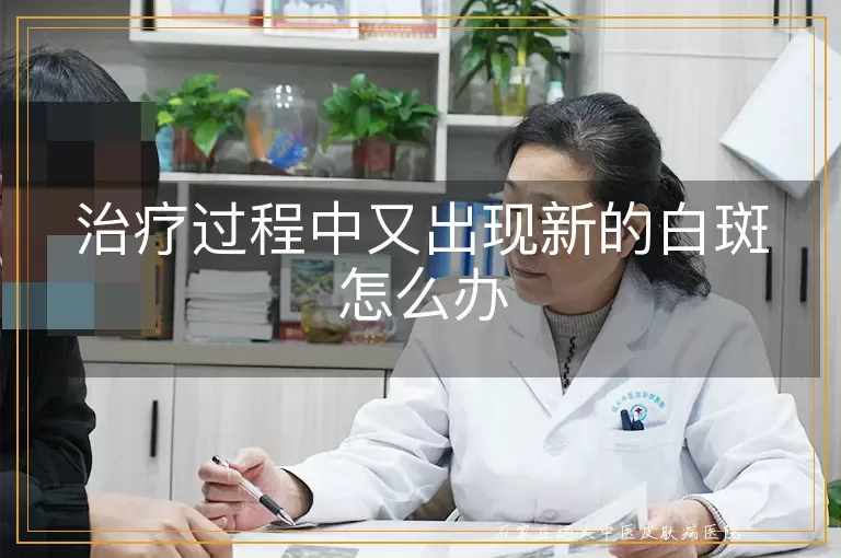 治疗过程中又出现新的白斑怎么办