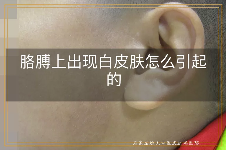 胳膊上出现白皮肤怎么引起的