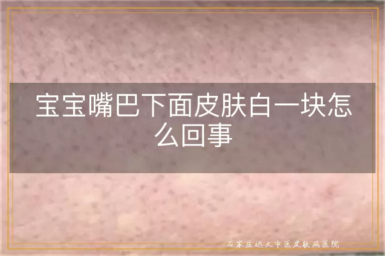 宝宝嘴巴下面皮肤白一块怎么回事