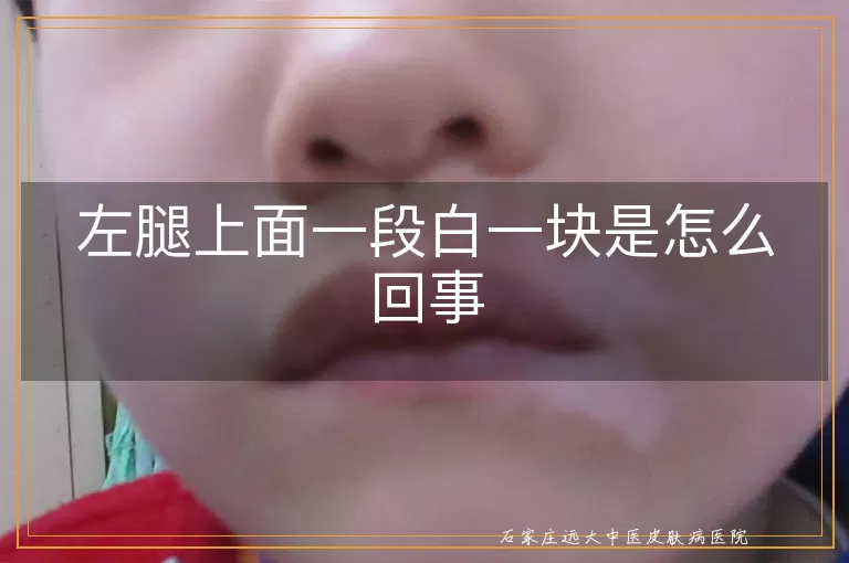 左腿上面一段白一块是怎么回事