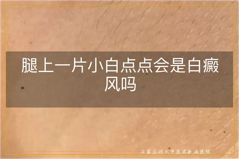 腿上一片小白点点会是白癜风吗