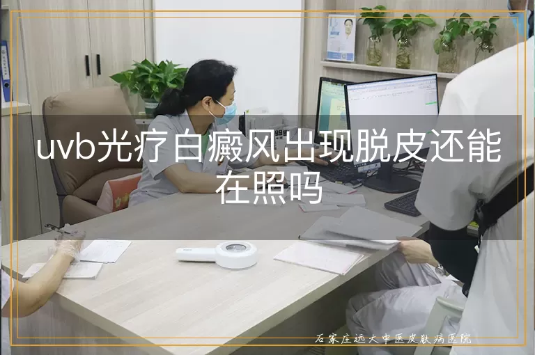uvb光疗白癜风出现脱皮还能在照吗