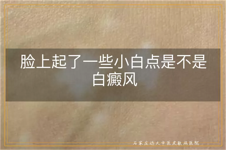 脸上起了一些小白点是不是白癜风