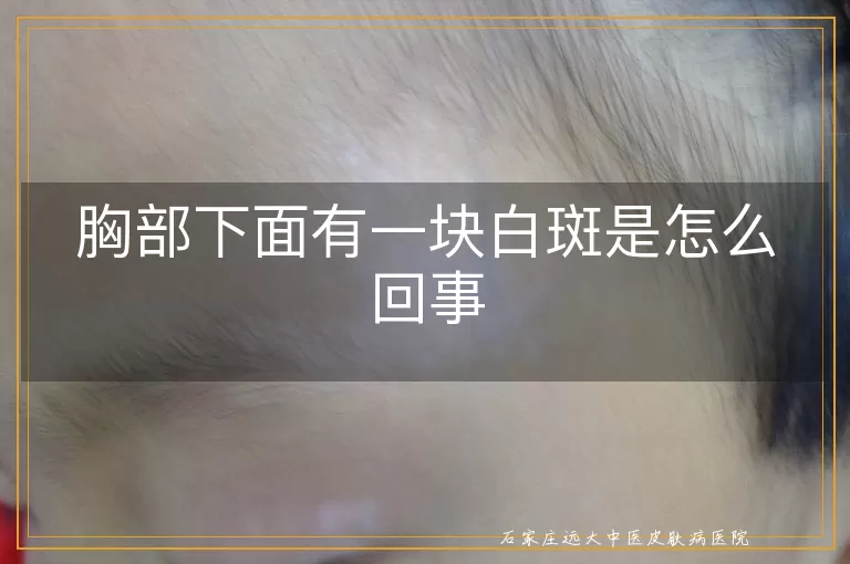胸部下面有一块白斑是怎么回事