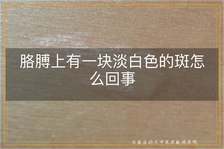 胳膊上有一块淡白色的斑怎么回事