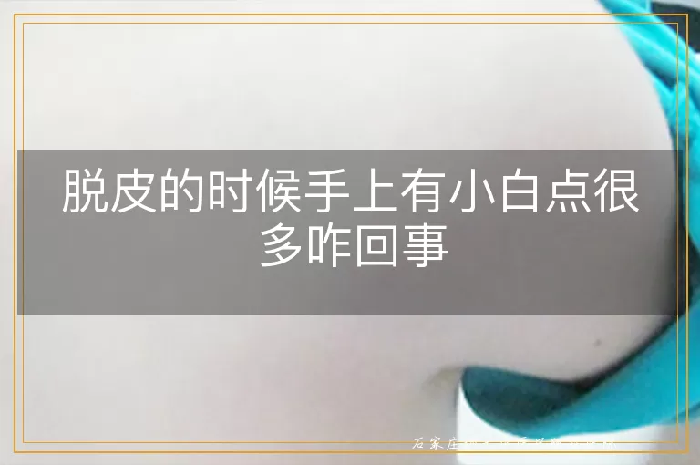 脱皮的时候手上有小白点很多咋回事