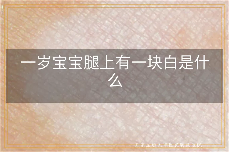 一岁宝宝腿上有一块白是什么