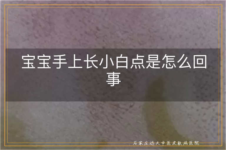 宝宝手上长小白点是怎么回事