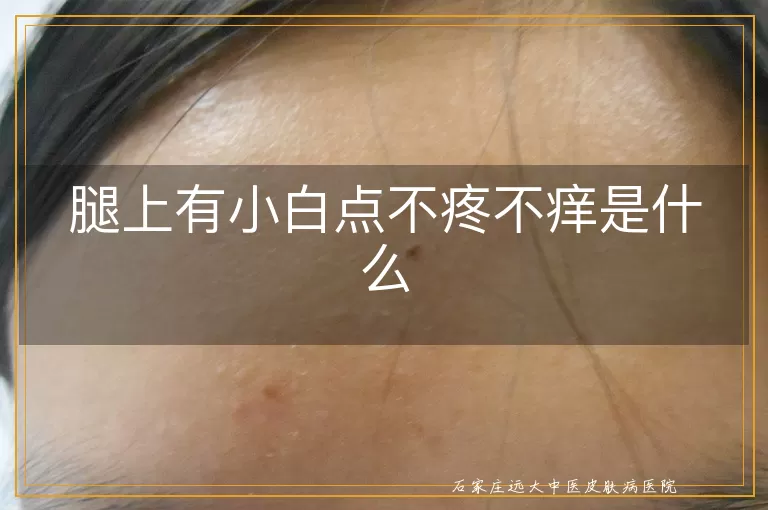 腿上有小白点不疼不痒是什么