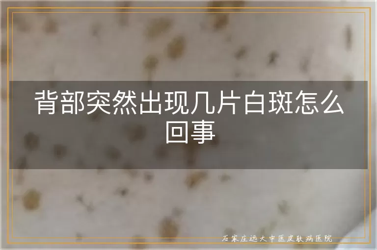 背部突然出现几片白斑怎么回事