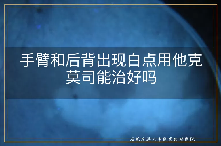 手臂和后背出现白点用他克莫司能治好吗