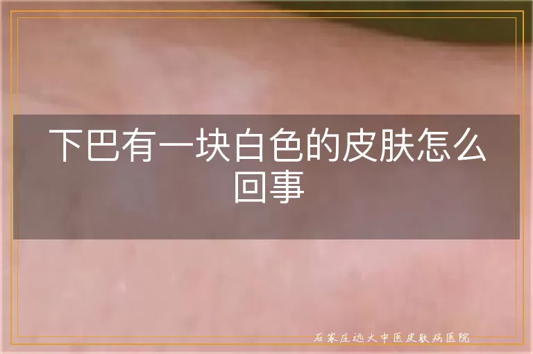 下巴有一块白色的皮肤怎么回事