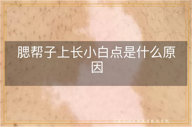 腮帮子上长小白点是什么原因
