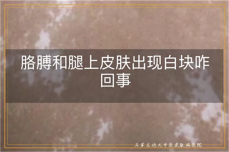 胳膊和腿上皮肤出现白块咋回事