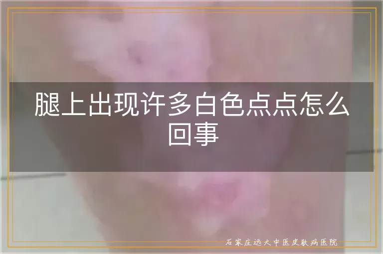 腿上出现许多白色点点怎么回事