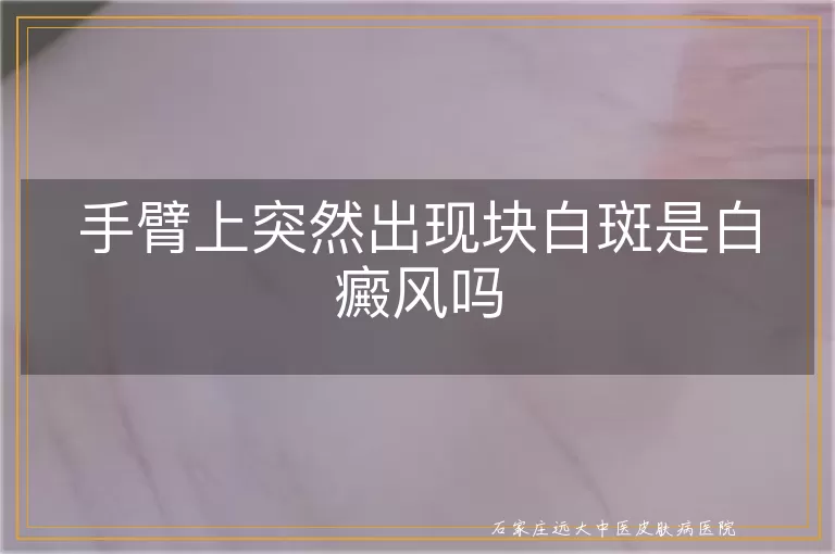 手臂上突然出现块白斑是白癜风吗