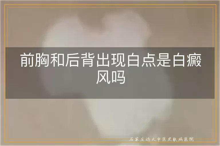 前胸和后背出现白点是白癜风吗